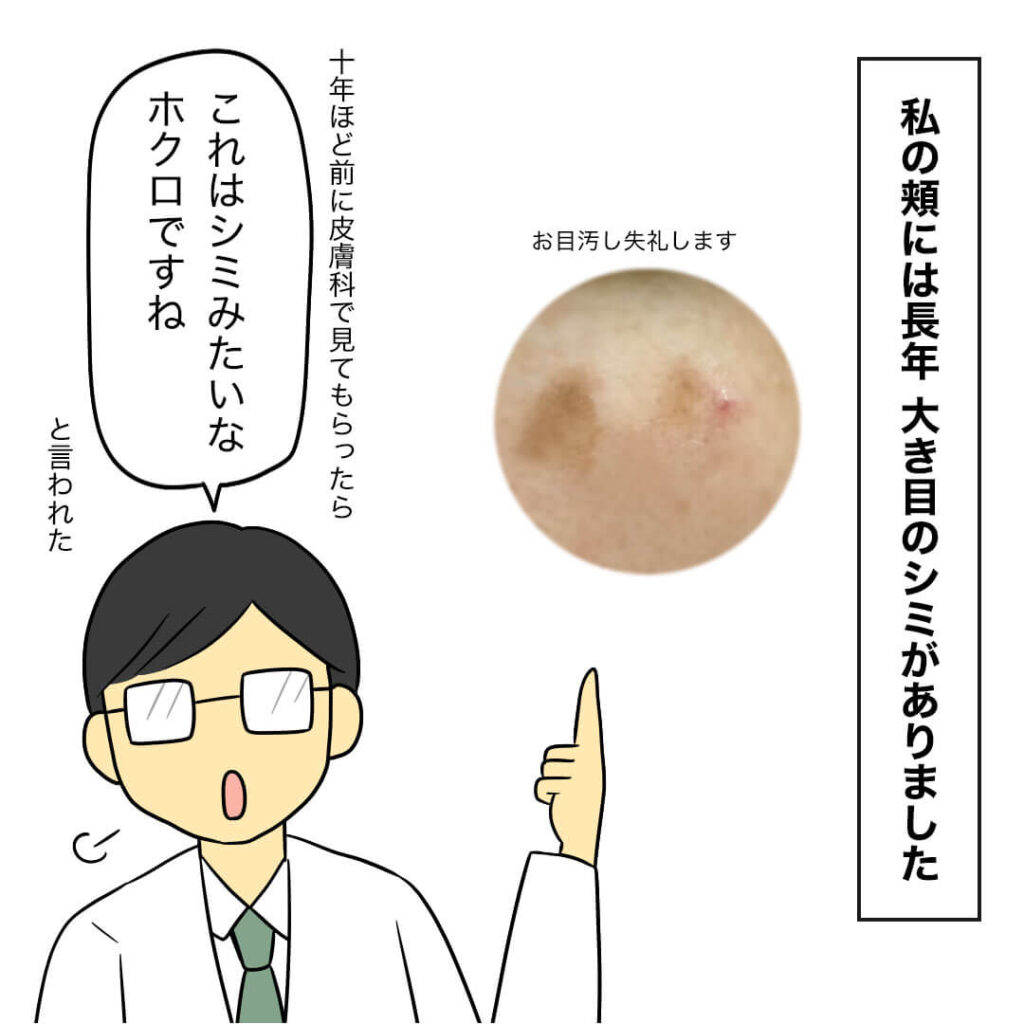 シミ取りをしたい40代主婦のマンガ