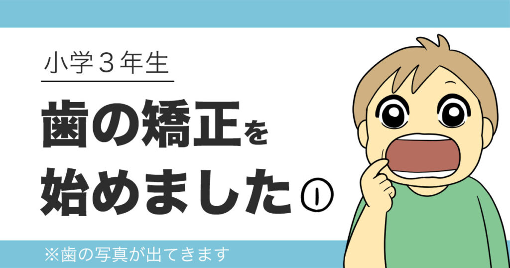マイオブレースによる子どもの歯列矯正を始めた記録ブログのタイトル画像